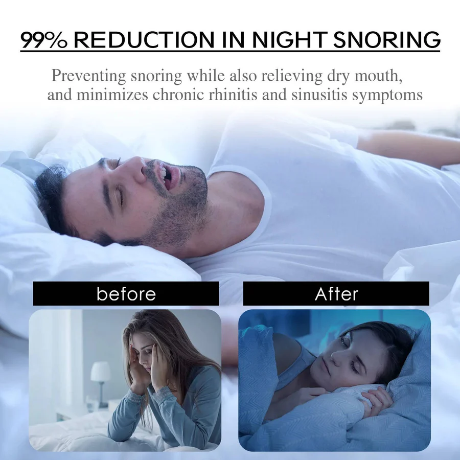 Mouth tape against snoring – Sleep aid & nasal breathing strips