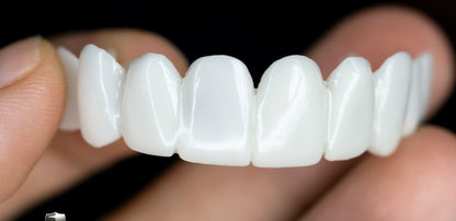 Dental Prosthesis – Realistic Cosmetic Teeth Cover