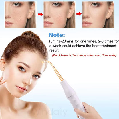 Fast-Acting Acne-Clearing Wand - Blemish & Pimple Treatment