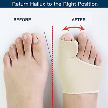 Bunion Corrector Sleeve with Gel Pad - 1 Pair