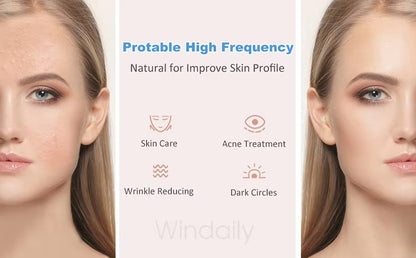 Fast-Acting Acne-Clearing Wand - Blemish & Pimple Treatment