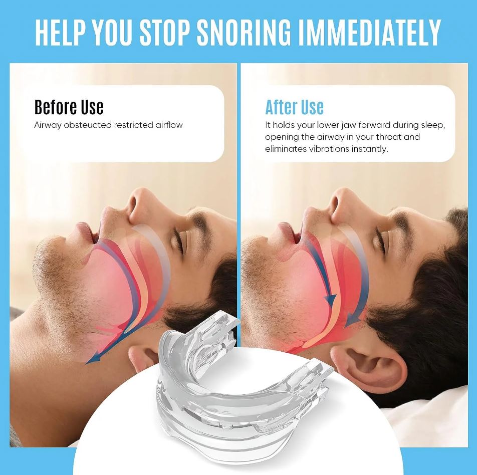Advanced Anti-Snore Mouthpiece – Adjustable, Comfortable Snoring Solution for Men & Women – Improve Sleep & Reduce Apnea