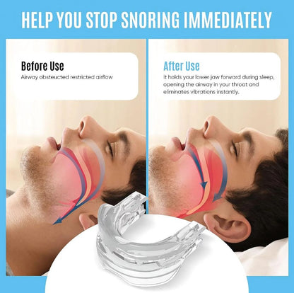 Advanced Anti-Snore Mouthpiece – Adjustable, Comfortable Snoring Solution for Men & Women – Improve Sleep & Reduce Apnea
