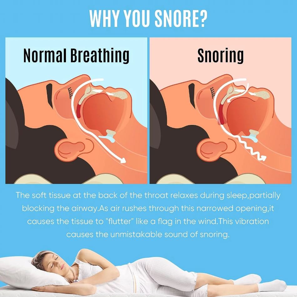 Advanced Anti-Snore Mouthpiece – Adjustable, Comfortable Snoring Solution for Men & Women – Improve Sleep & Reduce Apnea