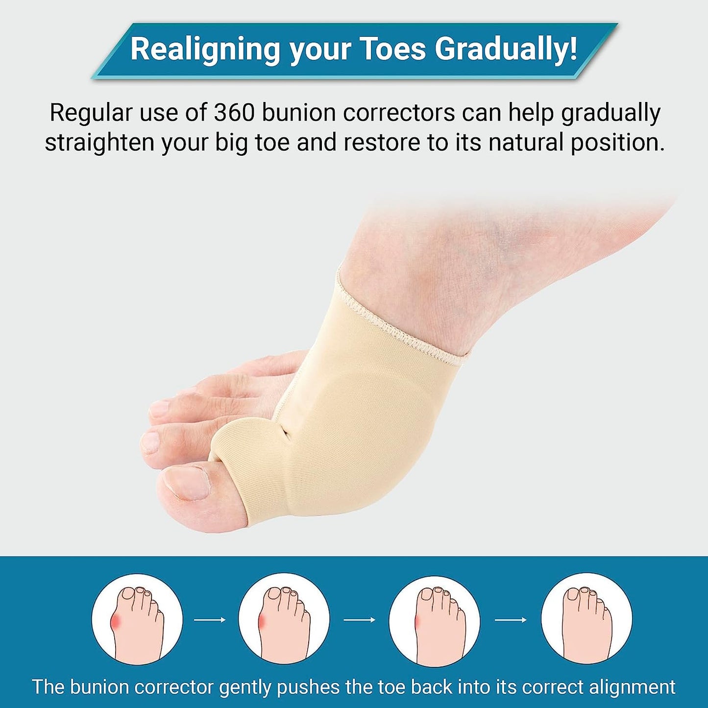Bunion Corrector Sleeve with Gel Pad - 1 Pair