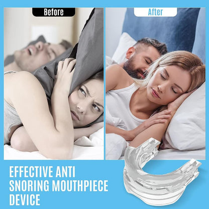 Advanced Anti-Snore Mouthpiece – Adjustable, Comfortable Snoring Solution for Men & Women – Improve Sleep & Reduce Apnea