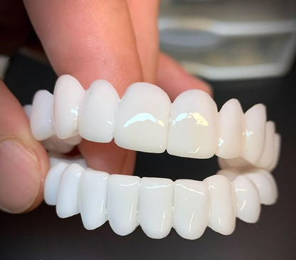 Dental Prosthesis – Realistic Cosmetic Teeth Cover