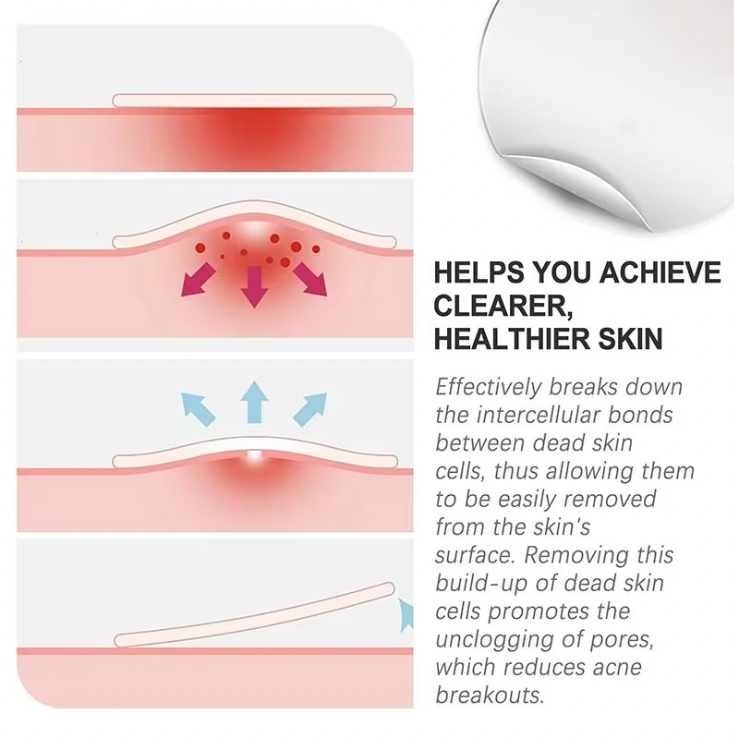 Hydrocolloid Pimple Patches – Invisible Acne Dots