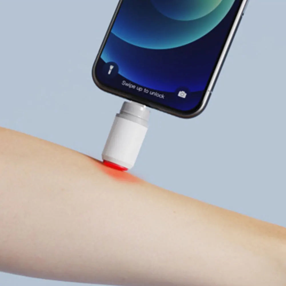 Mosquito Bite Relief Pen for Instant Itch Relief