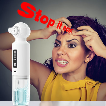 Electric Blackhead Remover – Pore Cleaner & Vacuum