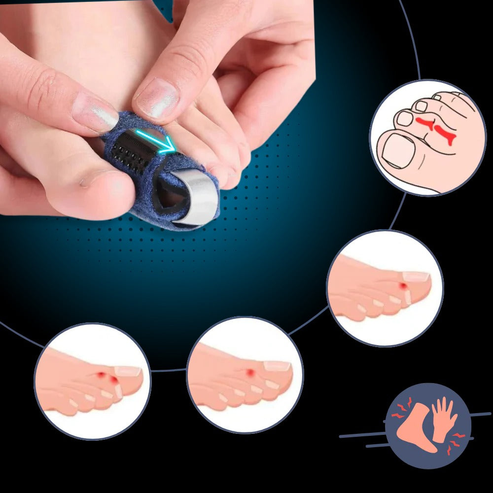 Adjustable Toe Straightener Corrector Device
