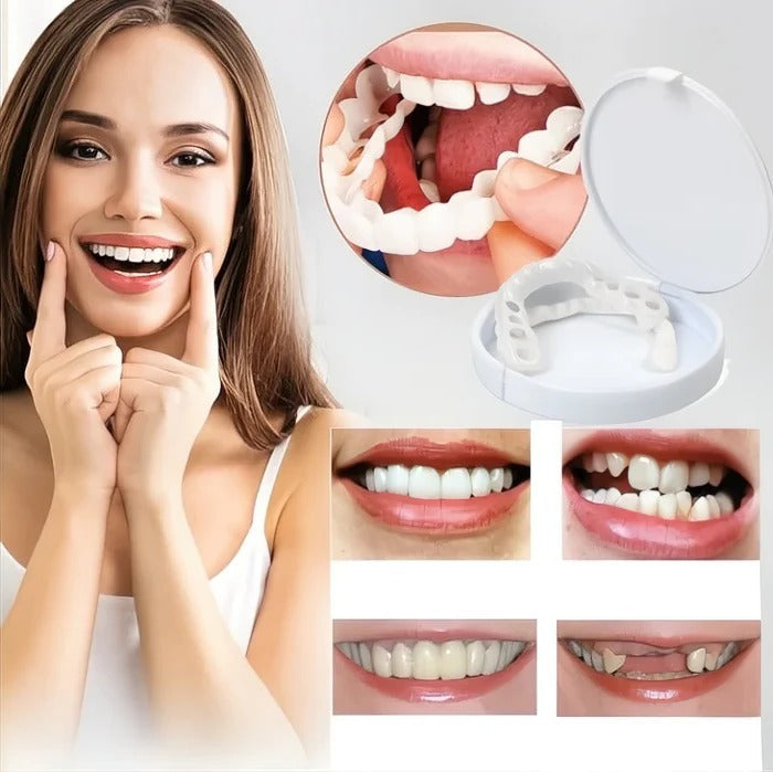 Natural White Cosmetic Veneers for Teeth