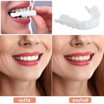 Natural White Cosmetic Veneers for Teeth