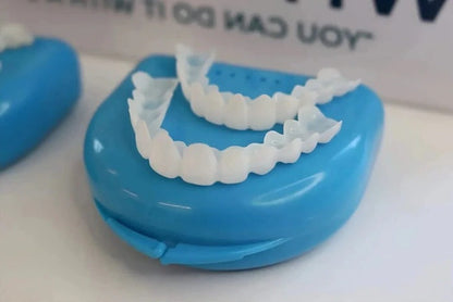 Natural White Cosmetic Veneers for Teeth