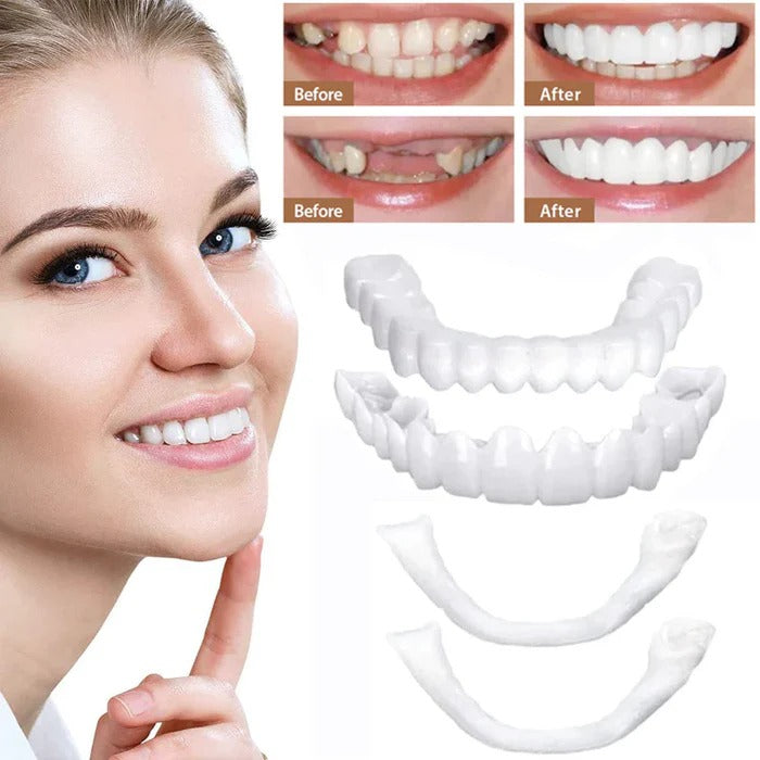 Natural White Cosmetic Veneers for Teeth