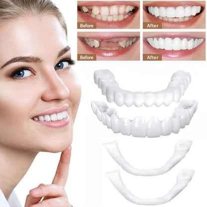 Natural White Cosmetic Veneers for Teeth
